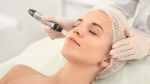 Woman having microneedling facial