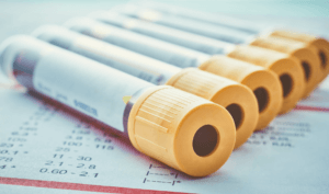 blood vials for kidney function test