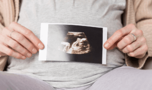 expecting mother showing her baby's 4d pregnancy scan