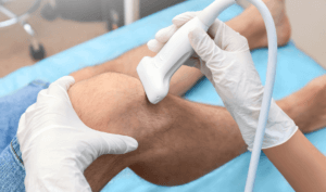 ultrasound scan on a lump on the knee