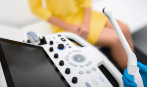 transvaginal ultrasound machine