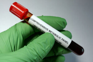 Comprehensive metabolic panel