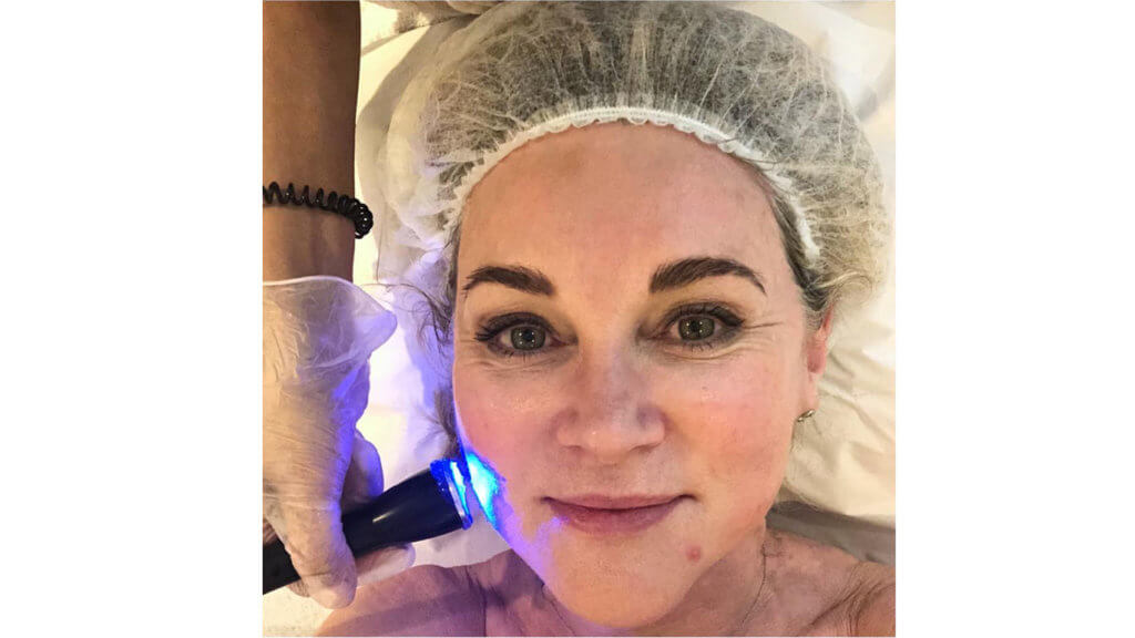 Anthea Turner’s Skincare Secrets