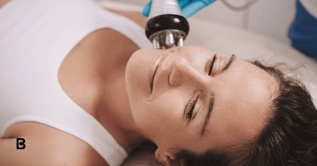 Radio Frequency Facials