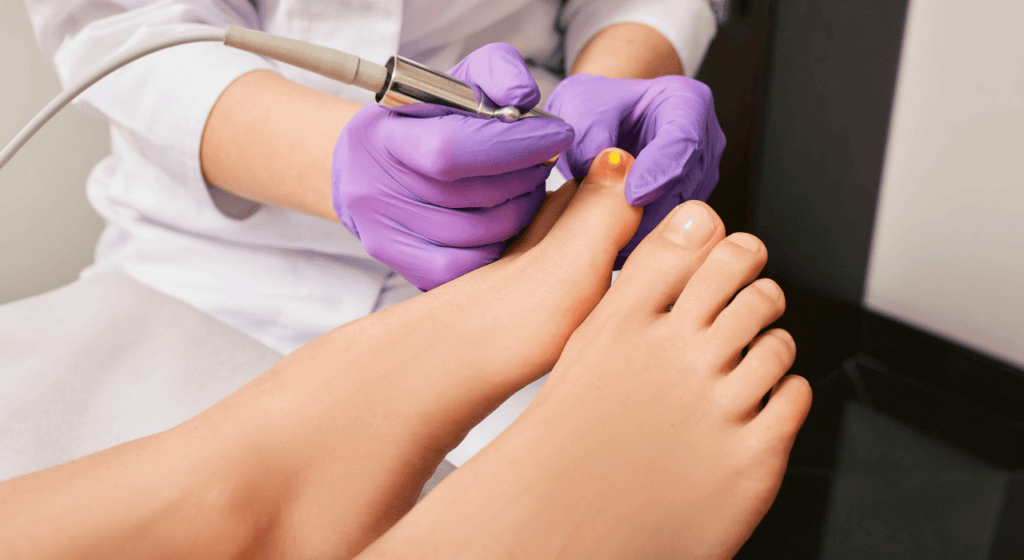 How To Protect Yourself Against Fungal Nail Infection