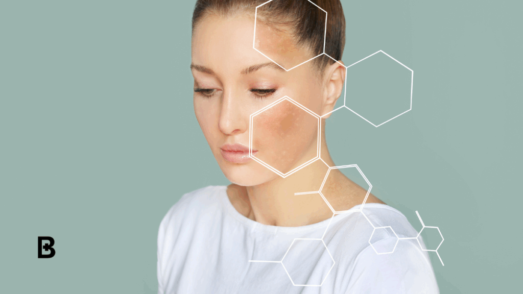 How To Treat Sun Damaged Skin Non-Surgically