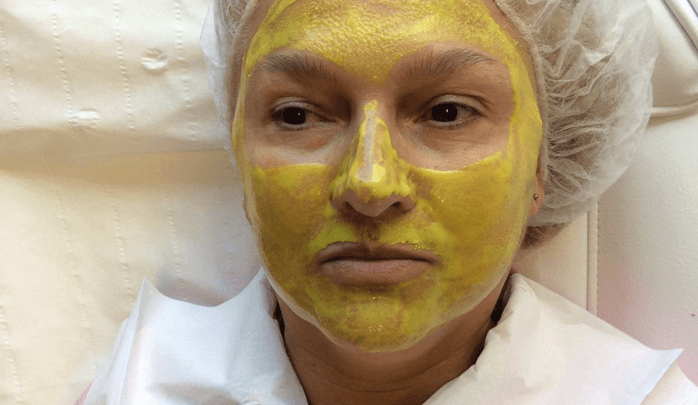 Facial peeling using Mask Professional