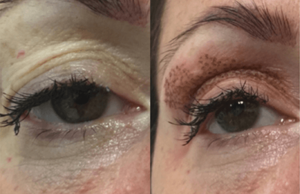 It’s all in the eyes