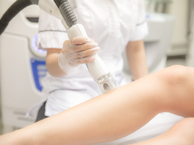 Laser hair removal machine of the future?
